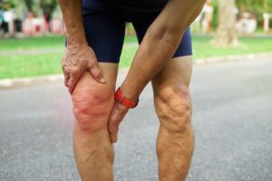 Non Surgical Knee Pain Relief
